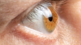 أفضل مركز علاج القرنية المخروطية بالليزر في مصر