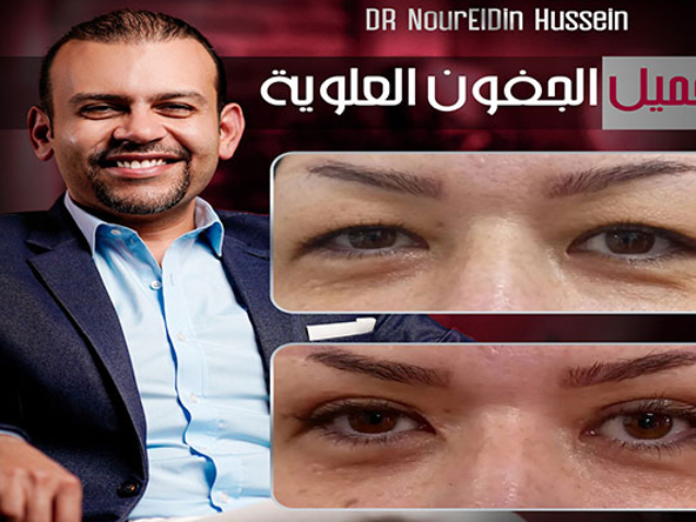 أفضل دكتور تجميل جفون في مصر