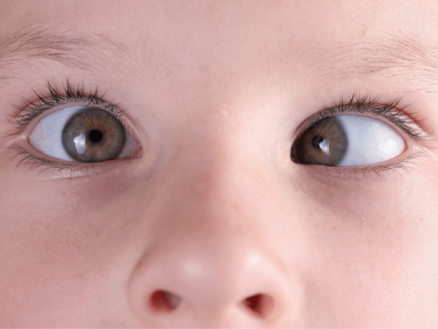 حول الأطفال وأنواعه