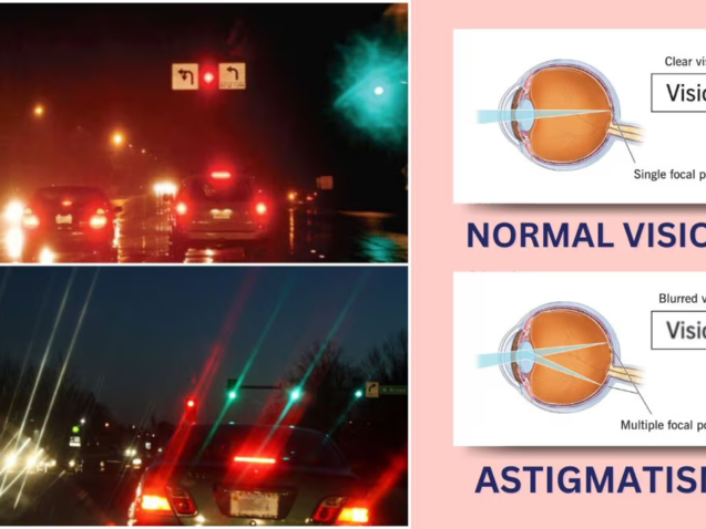 الاستجماتيزم: تعريف المرض، أسبابه، أعراضه وطرق علاجه