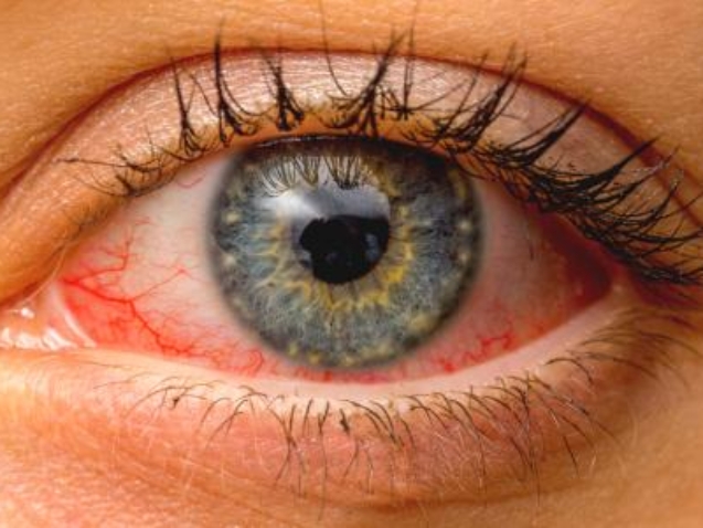 أفضل دكتور شبكية فى مصر