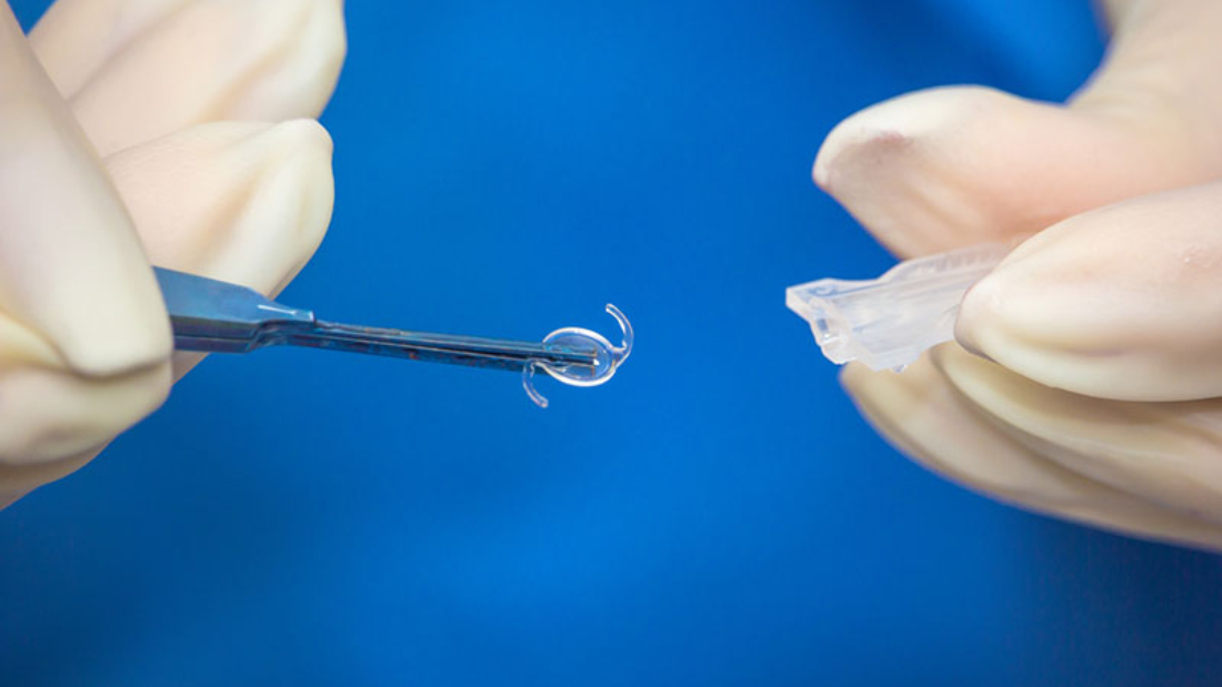intraocular-lens-implant2