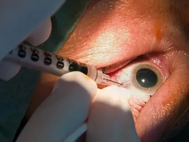 حقن العين لعلاج الارتشاح لدى مرضى السكري